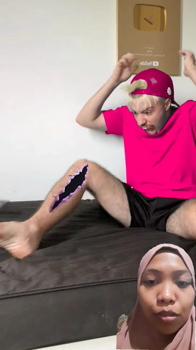 Ulat masuk kedalam tubuh #funny #viral #lucu #classicminiature #crocsclassic #shorts #videoshort