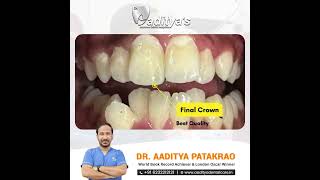 Dr Aaditya Patakrao The Smile Design Process Top Dentist In Pune Top Dentist Smile Makeover