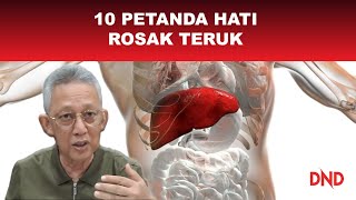 10 Petanda yang LIVER (Hati) Anda dah Teruk Rosak...Sampai Boleh Kata Goodbye!