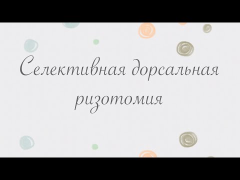 Селективная дорсальная ризотомия в реабилитации