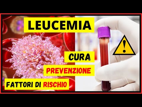 Leucemia: quali sono i fattori di rischio? Quali sono le possibili cure? E&rsquo; possibile prevenirla?