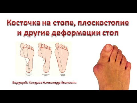 Здоровье Ваших Стоп