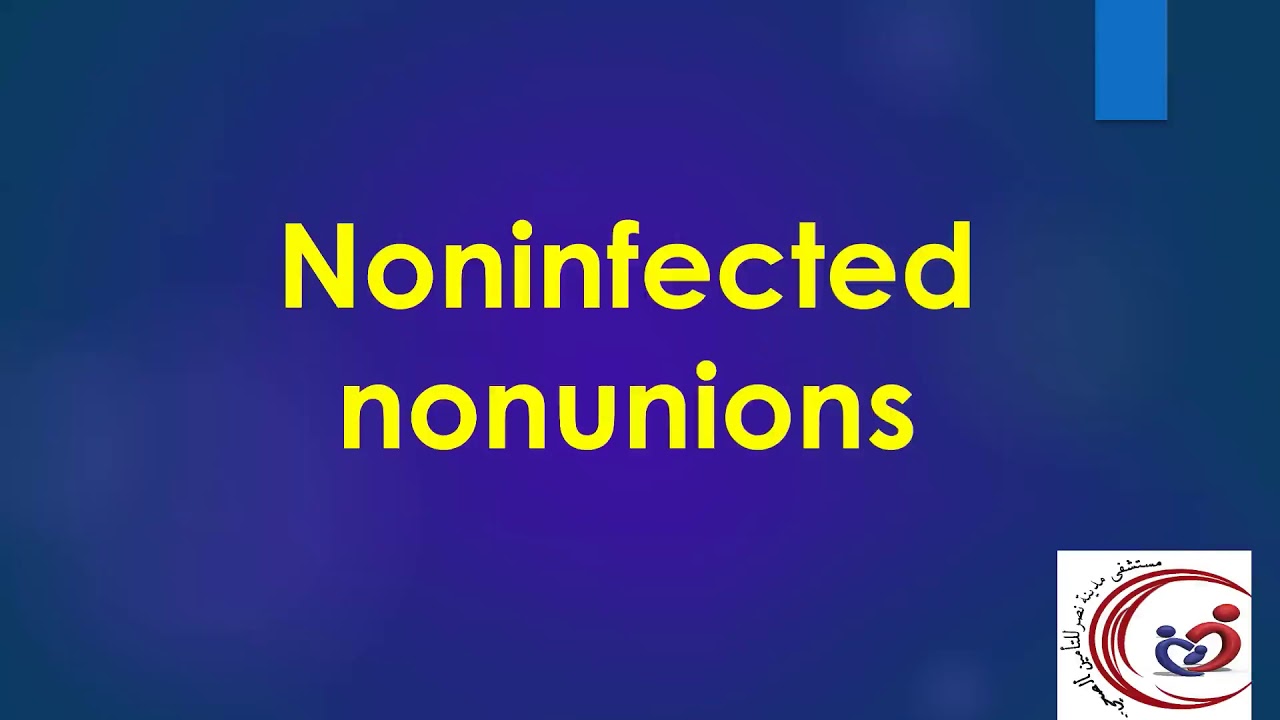 Non-union fracture management. Dr. Mohamed Fathey. nasrcity covid19 online lectures 2020