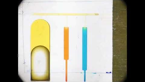 Microfluidic Capillaric Circuit for Rapid and Simple Bacteria Detection