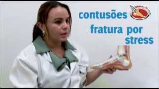 Após tratamento graves queda contusões para uma
