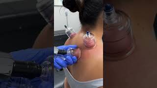Neck pain? Headaches? Stress? 😳 Check this out! #kingofcracks #chiropractor #asmr #shorts