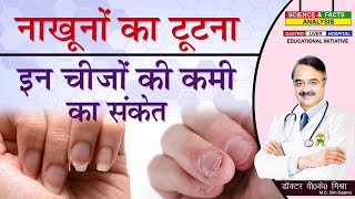 नाखूनों का टूटना इन चीजों की कमी का संकेत || WEAK NAILS HERE ARE SOME NUTRIENTS YOU LACK screenshot 1