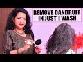 இனி பொடுகுக்கு Bye Bye...! | Dandruff & Hairfall Tips | Vasunthara Series