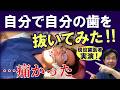 自分で自分の歯を抜いてみた！…痛かった🥲