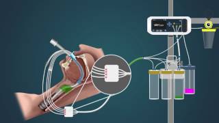 VAPCare: Product description