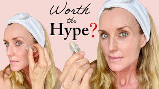 BETTER than Microneedling? Testing the very popular Qure Micro Infusion System