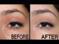 Concealing Under Eye Puffiness/Bags Below the Eyes