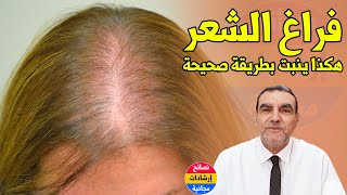الطريقة الصحيحة لإنبات فراغات الشعر المتساقط مع الدكتور محمد الفايد