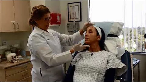 Sculptra Injection | Dr. Critelli