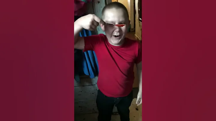 Boy cant take the burn