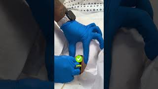 Inserting With Confidence The Female Catheter