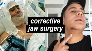 Corrective Jaw Surgery Changed My Life! *The Truth About My Orthognathic Procedure* | JairWoo