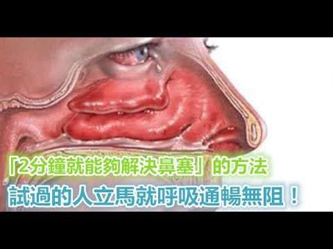 教大家用 2分鐘就解決鼻塞 的方法 試過的人立馬就呼吸通暢無阻 Youtube