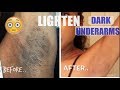 DIY: How To LIGHTEN DARK UNDERARMS NATURALLY! | Dramatic Results