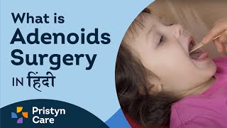 What is Adenoids Surgery in hindi