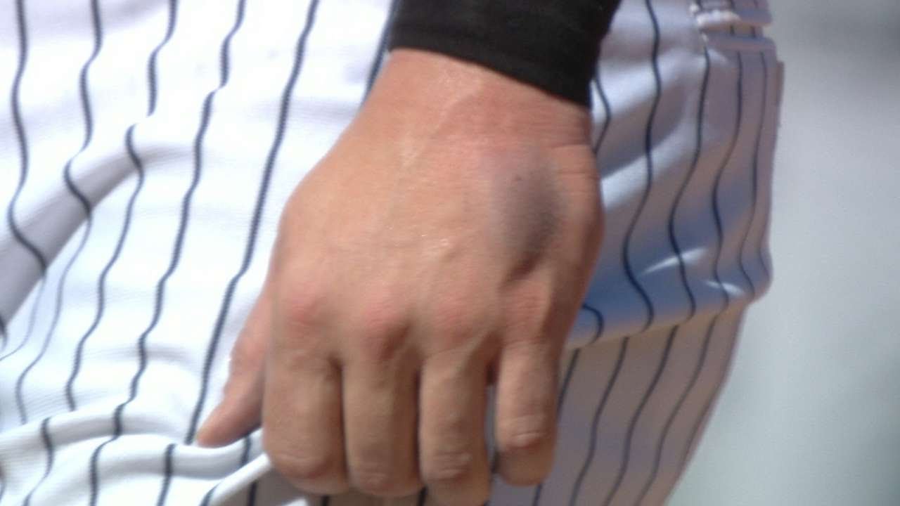 TB@NYY: Romine gets hit in the throat, head and hand