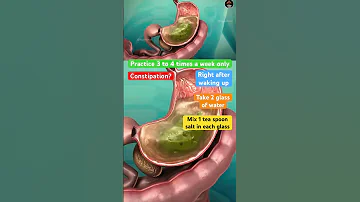 Clean Colon From Stuck Old Poop Ibs Colon Cleaning Constipation 