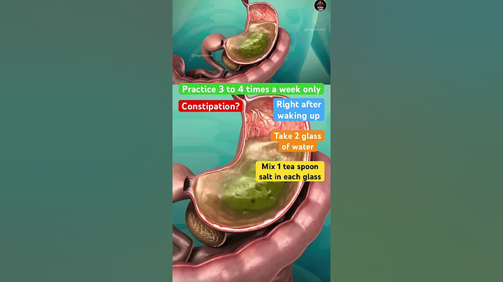 🔥Clean Colon from Stuck Old Poop #ibs #colon #cleaning #constipation