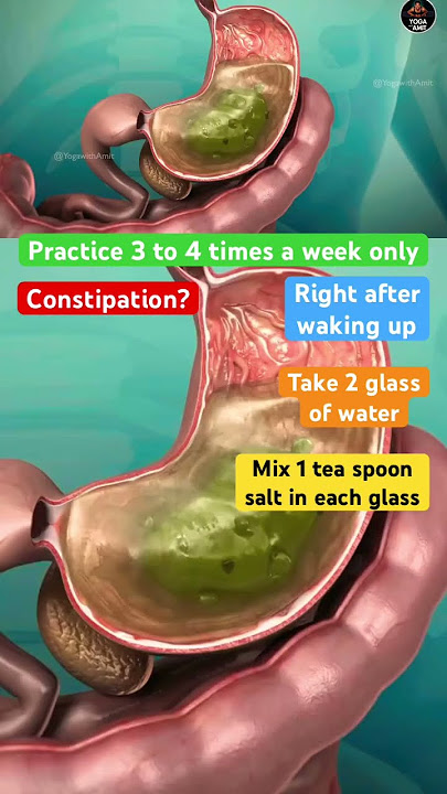 🔥Clean Colon from Stuck Old Poop #ibs #colon #cleaning #constipation