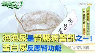 泡泡尿是腎臟病警訊之一！ 蛋白尿反應腎功能 健康2.0