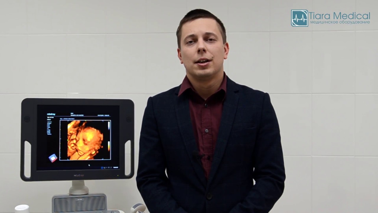 УЗИ сканер Mindray DC-N3. Обзор и отзыв