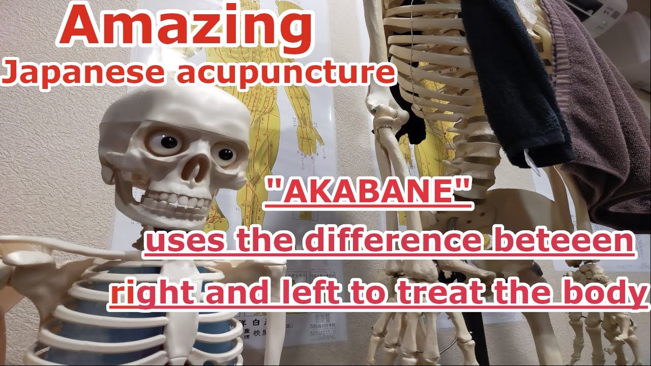 Acupuncture in Japan "AKABANE" YouTube