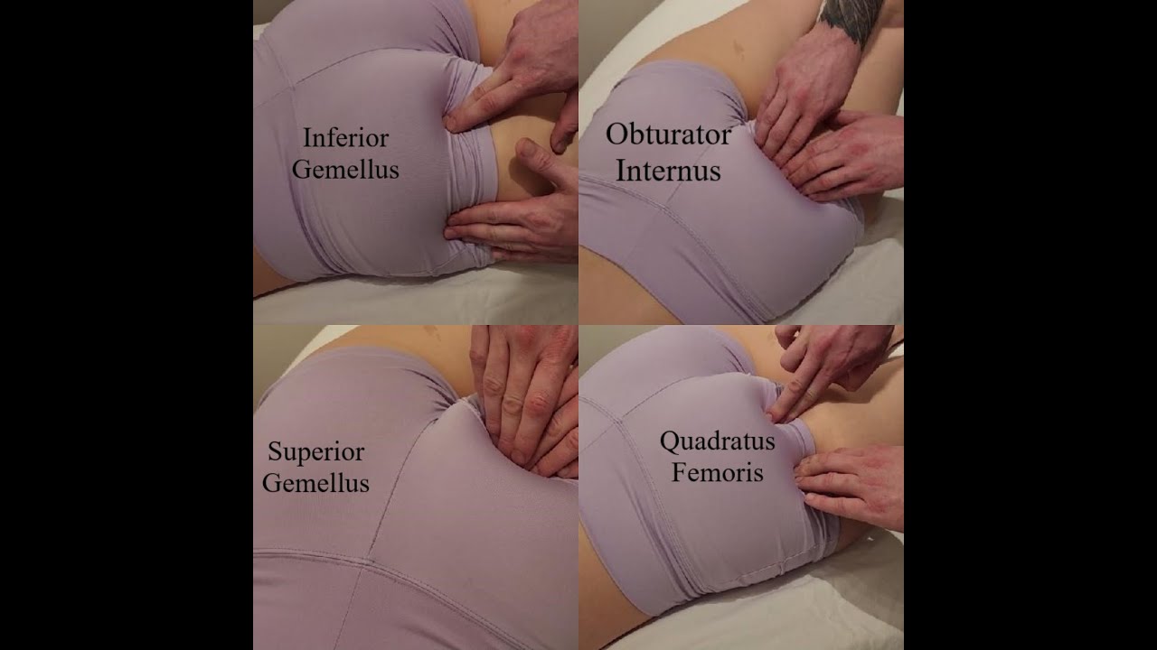 Пальпация мышц: верхняя и нижняя близнецы, квадратная мышца бедра, внутренняя запирательная мышца.