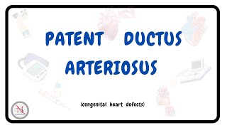 Patent Ductus Arteriosus Causes Symptoms Pathophysiology Treatment The Nurses Station