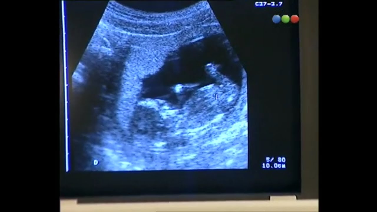 Franco y Serena 32 | Don Juan y Su Bella Dama