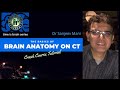 Time is brain series  ct brain  anatomy tutorial  dr sanjeev mani  neuroparenchyma  ventricles
