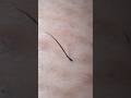 登録者さん8000人！ありがとうございます！#hairremoval #毛抜き #satisfying