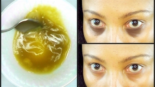 GET RID OF DARK CIRCLES + EYE BAGS IN 7 DAYS, EFFECTIVE!! PUFFINESS, SWOLLEN EYELIDS |Khichi Beauty