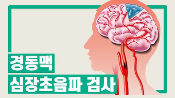 [서울성모병원] 경동맥 심장초음파 검사