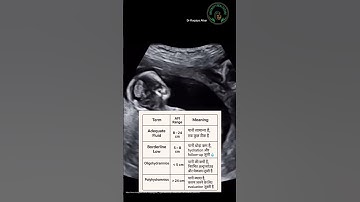 amniotic fluid is baby’s first home.#medical #doctor #ytshorts #facts #biology #sonography