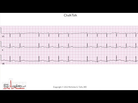 ECG Academy ChalkTalk Coaching #517