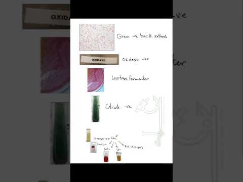 لغز البكتيريا الغامضة مايكروبيولوجي البكتيريا الفطريات الفيروسات مقاومة المضادات