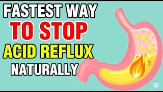 STOP Acid Reflux FAST (Best Natural Remedies You NEED to Try)