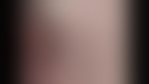 laparoscopic right nephrectomy in 10 steps by prof Dr Soliman Elshakhs