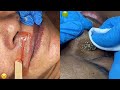 Most Extreme Beauty Treatments 2022 Best Smart and Helpful Beauty Hacks | Virtual Beauty