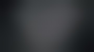 Dr. Joseph R. Karam - Robotic TAPP Bilateral Inguinal hernia