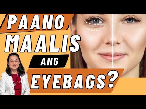 Video: 5 Mga Simpleng Paraan upang Magamot ang Under Eye Wrinkles