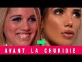 Les stars de tlralit avant la chirurgie esthtique  manon  nabilla maeva ghennam paga