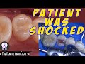 Tooth Restoration Patient Complained on an existing Tooth Restoration (PASTA) #C8