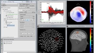 Brainstorm: Imaging neural activity at the speed of brain screenshot 1