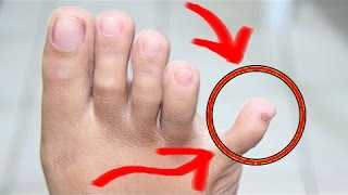 هل تعلم | ما هي فائدة الإصبع الصغير في قدميك؟ سبحان الله